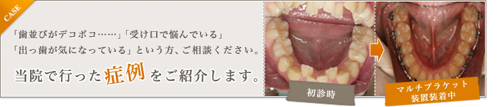 症例